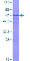 12.5% SDS-PAGE Stained with Coomassie Blue